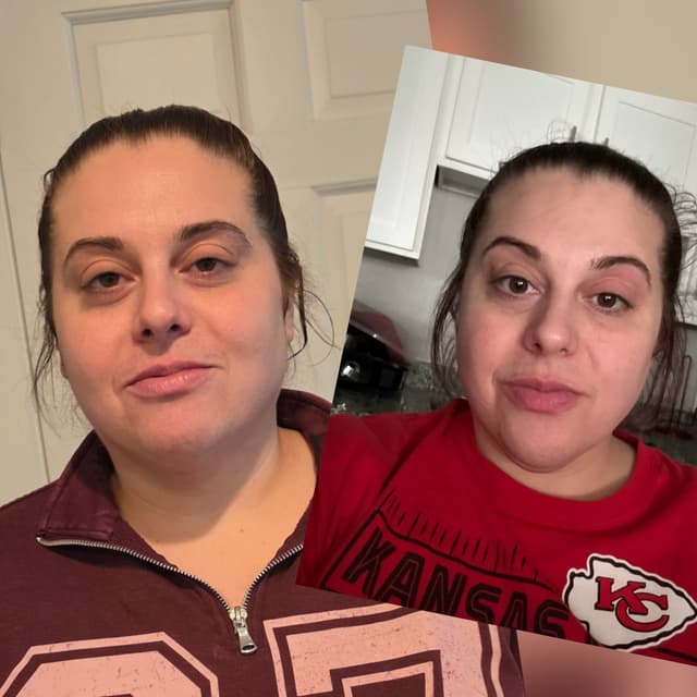 Double Chin Slim at Sculpt Society in INDEPENDENCE, MO